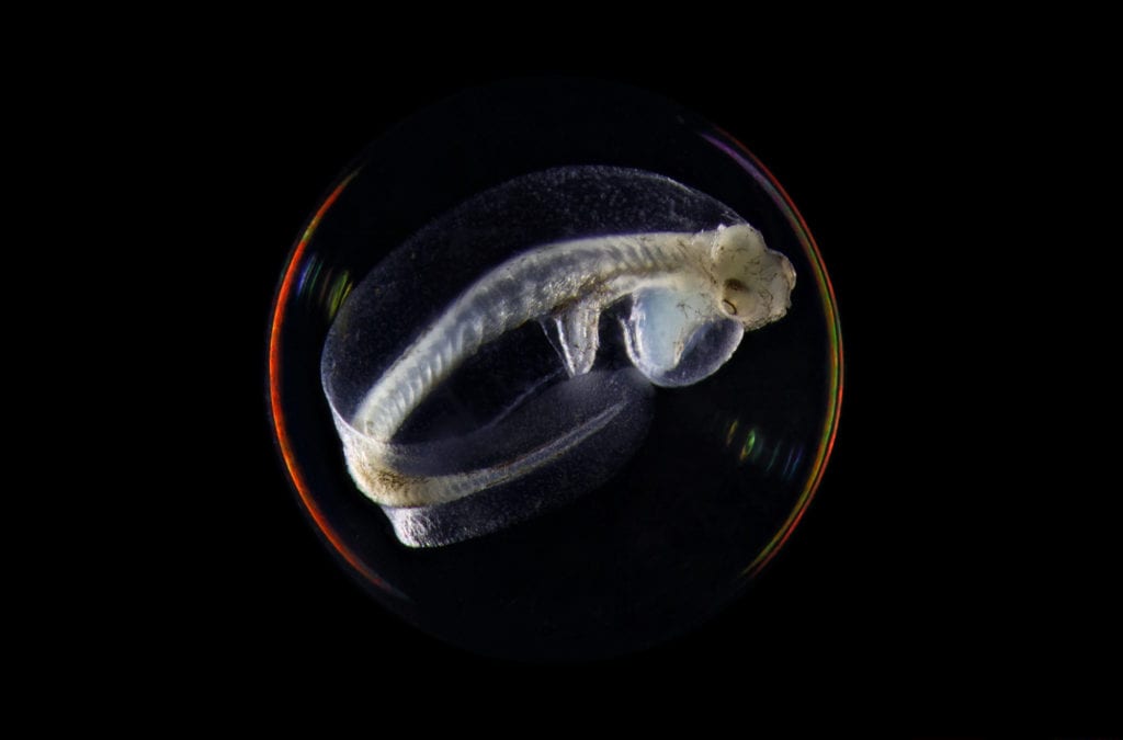 An unhatched Flathead Sole (Hippoglossoides elassodon) rests in its egg (4 mm; about the size of a ball bearing). Once hatched, this fish could grow to a size that would make any sport fisherman proud. This specimen was collected from Cook Inlet and photographed through a microscope at the Prince William Sound Science Center using a technique called focus stacking. Photo courtesy of Caitlyn McKinstry/Prince William Sound Science Center
